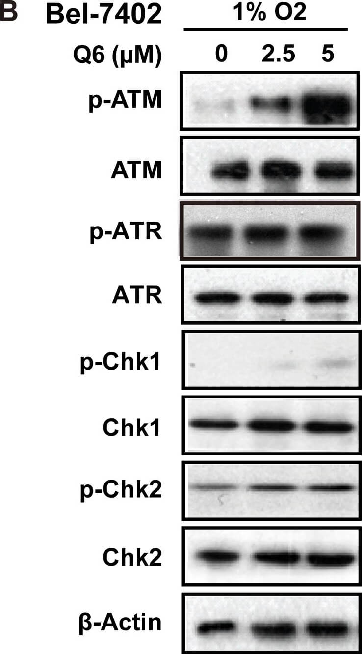 Western Blot of Anti-ATM Western Blot of Anti-ATM