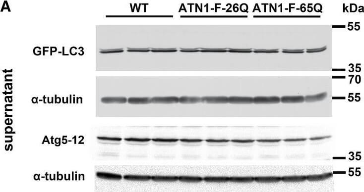 Western Blotting of Anti-ATG13 pS318 Western Blotting of Anti-ATG13 pS318