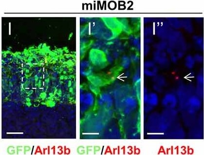 Immunohistochemistry of Anti-RFP Immunohistochemistry of Anti-RFP
