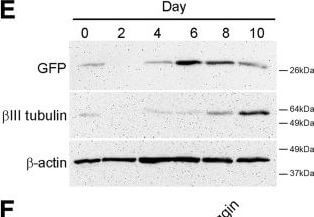 Western Blot of Anti-GFP Western Blot of Anti-GFP