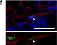 Immunohistochemistry of Anti-Collagen Type IV Immunohistochemistry of Anti-Collagen Type IV