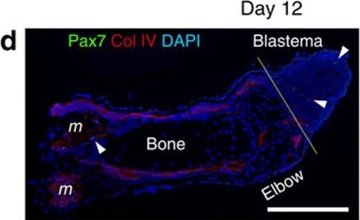 Immunohistochemistry of Anti-Collagen Type IV Immunohistochemistry of Anti-Collagen Type IV