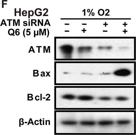 Western Blot of Anti-ATM Western Blot of Anti-ATM