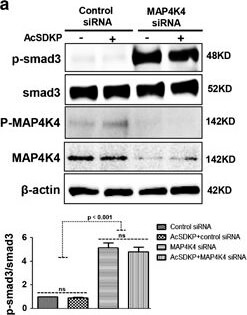 Western Blot of Anti-SMAD3 pS423 pS425 Western Blot of Anti-SMAD3 pS423 pS425