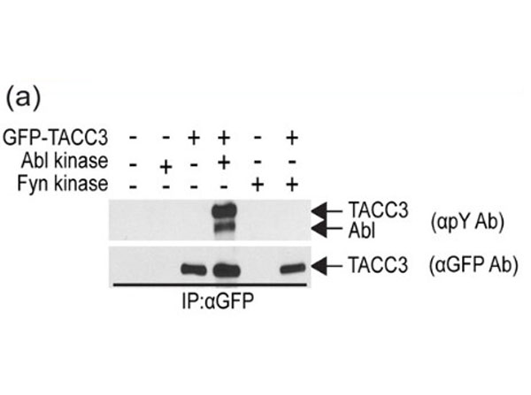 Immunoprecipitation using Protein A Immunoprecipitation using Protein A