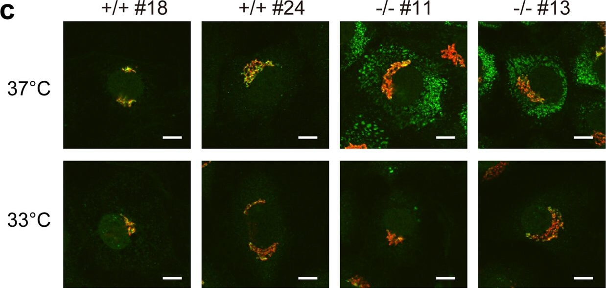 Immunocytochemistry of Anti-Collagen Type I Immunocytochemistry of Anti-Collagen Type I