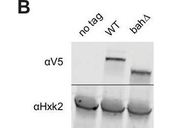 Western Blot of Anti-Hexokinase Antibody Western Blot of Anti-Hexokinase Antibody