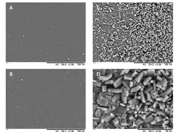 SEM using rabbit blood sodium citrate SEM using rabbit blood sodium citrate