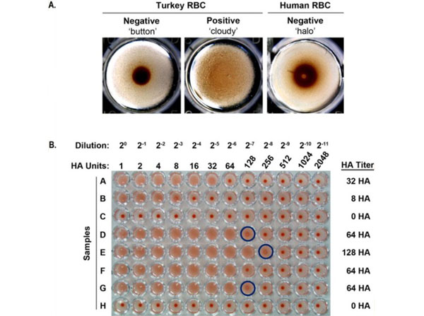 Hemagglutination using Turkey Red Blood Cells Hemagglutination using Turkey Red Blood Cells