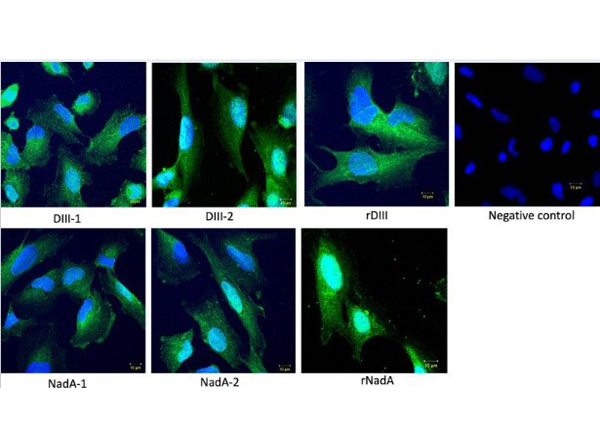 Immunofluorescence using Streptavidin Fluorescein Immunofluorescence using Streptavidin Fluorescein