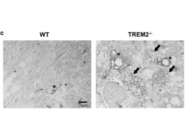 Immuno-electron microscopy using streptavidin-HRP Immuno-electron microscopy using streptavidin-HRP