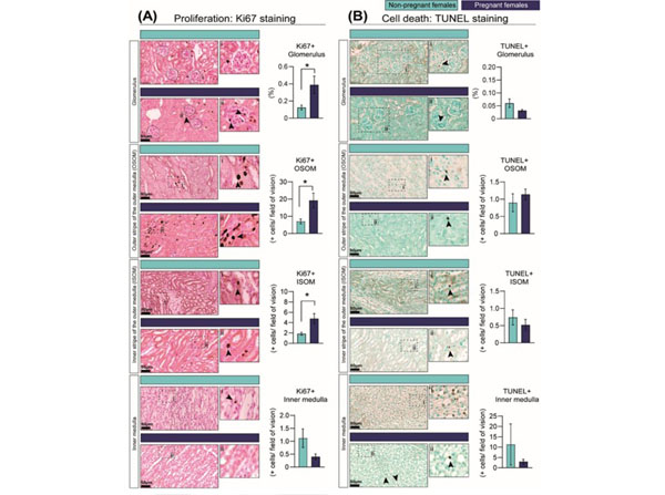 Immunohistochemistry using Streptavidin Peroxidase Immunohistochemistry using Streptavidin Peroxidase