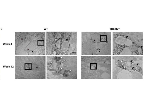 Immuno-electron microscopy using streptavidin-HRP Immuno-electron microscopy using streptavidin-HRP