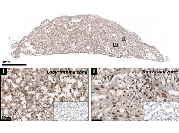 Immunohistochemistry using Streptavidin Peroxidase Immunohistochemistry using Streptavidin Peroxidase