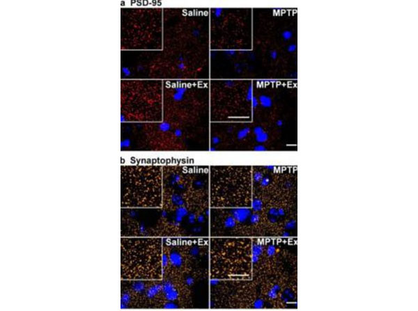 Immunofluorescence using Streptavidin CY5 Immunofluorescence using Streptavidin CY5