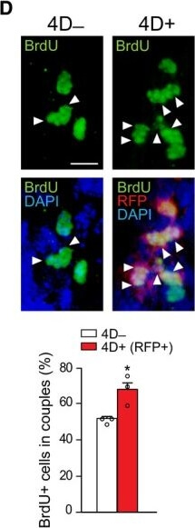 Immunohistochemistry of Anti-RFP Immunohistochemistry of Anti-RFP