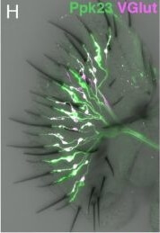 Immunohistochemistry of Anti-RFP Immunohistochemistry of Anti-RFP