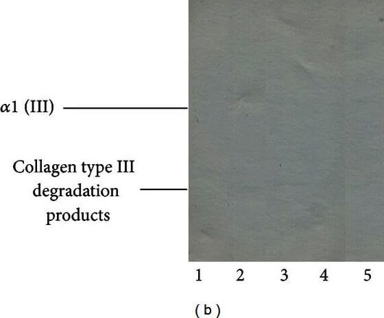Western Blot of Anti-Collagen Type III Western Blot of Anti-Collagen Type III