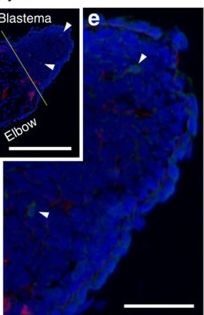 Immunohistochemistry of Anti-Collagen Type IV Immunohistochemistry of Anti-Collagen Type IV
