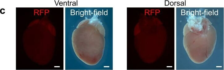 Immunohistochemistry of Anti-RFP Immunohistochemistry of Anti-RFP