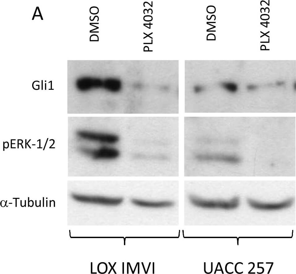 Western Blot of Anti-Gli1 Western Blot of Anti-Gli1