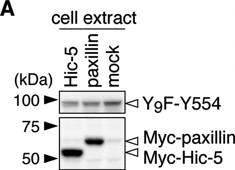 Western Blot of Anti-Myc Western Blot of Anti-Myc