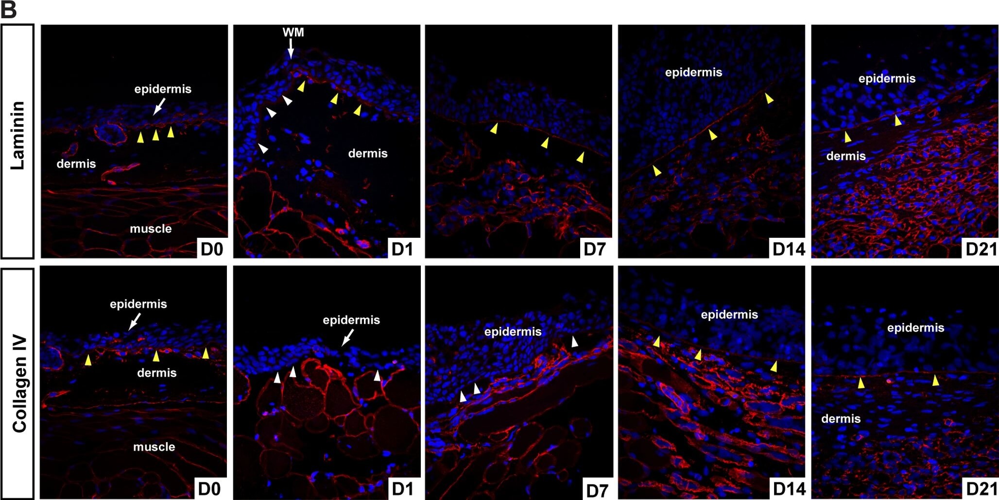 Immunohistochemistry of Anti-Collagen Type IV Immunohistochemistry of Anti-Collagen Type IV