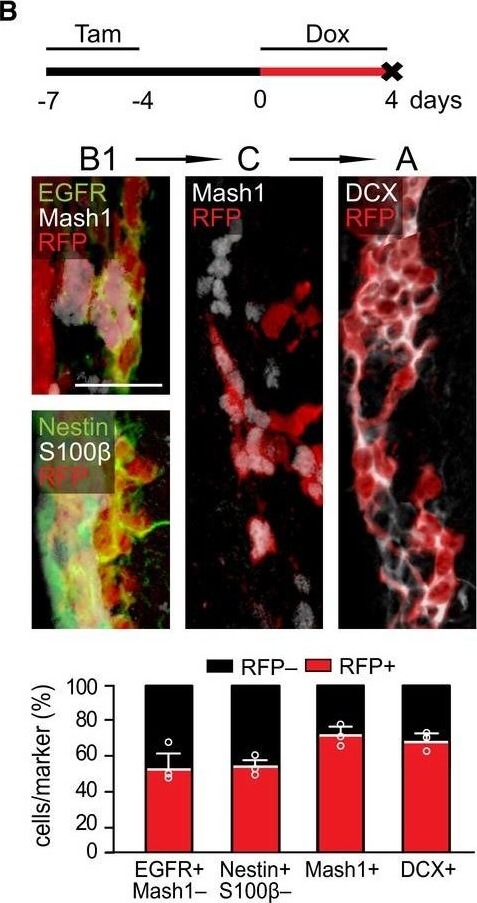 Immunohistochemistry of Anti-RFP Immunohistochemistry of Anti-RFP