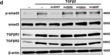 Western Blot of Anti-SMAD3 pS423 pS425 Western Blot of Anti-SMAD3 pS423 pS425