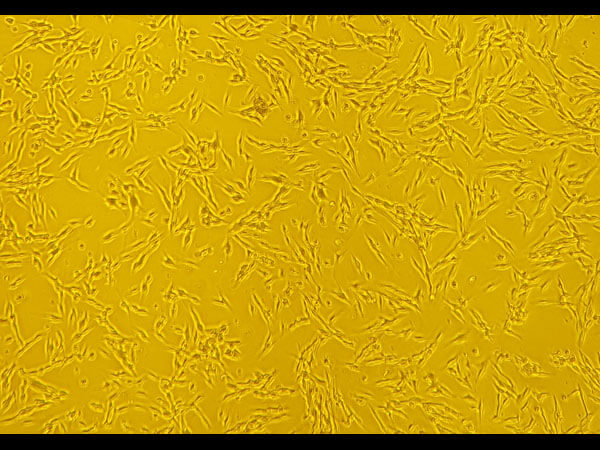 WM115 Viable Cells