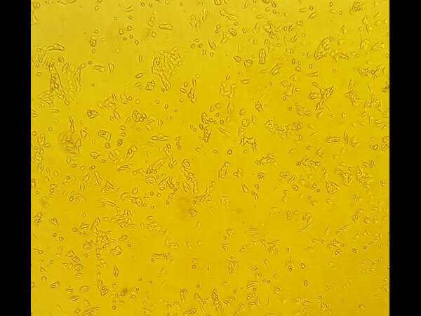 WM1341D Viable Cells