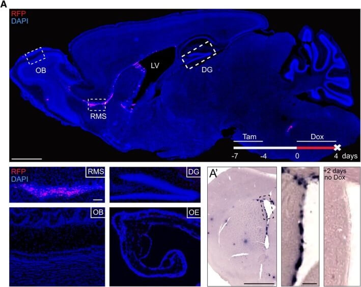 Immunohistochemistry of Anti-RFP Immunohistochemistry of Anti-RFP
