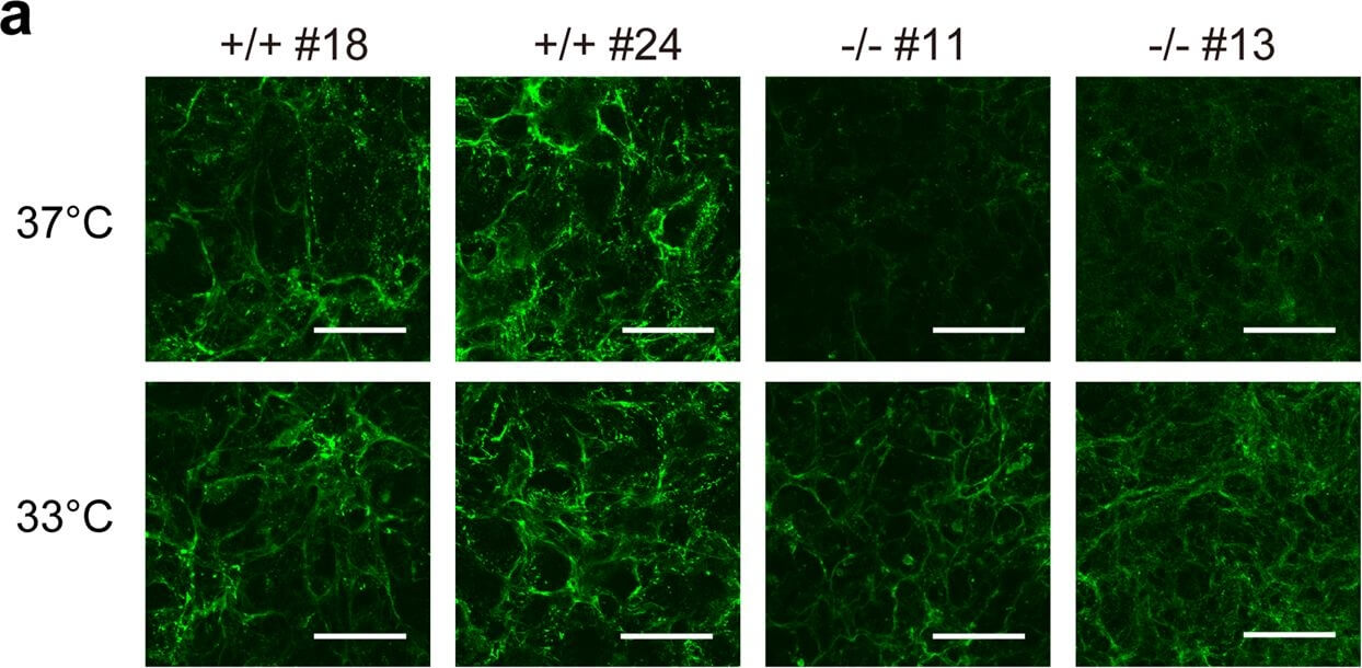 Immunocytochemistry of Anti-Collagen Type I Immunocytochemistry of Anti-Collagen Type I