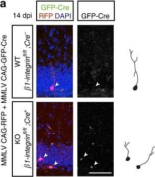 Immunohistochemistry of Anti-RFP Immunohistochemistry of Anti-RFP