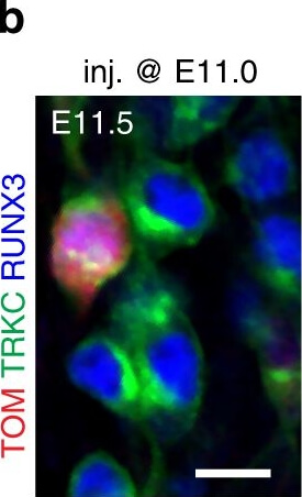 Immunocytochemistry of Chicken Anti-RFP Immunocytochemistry of Chicken Anti-RFP